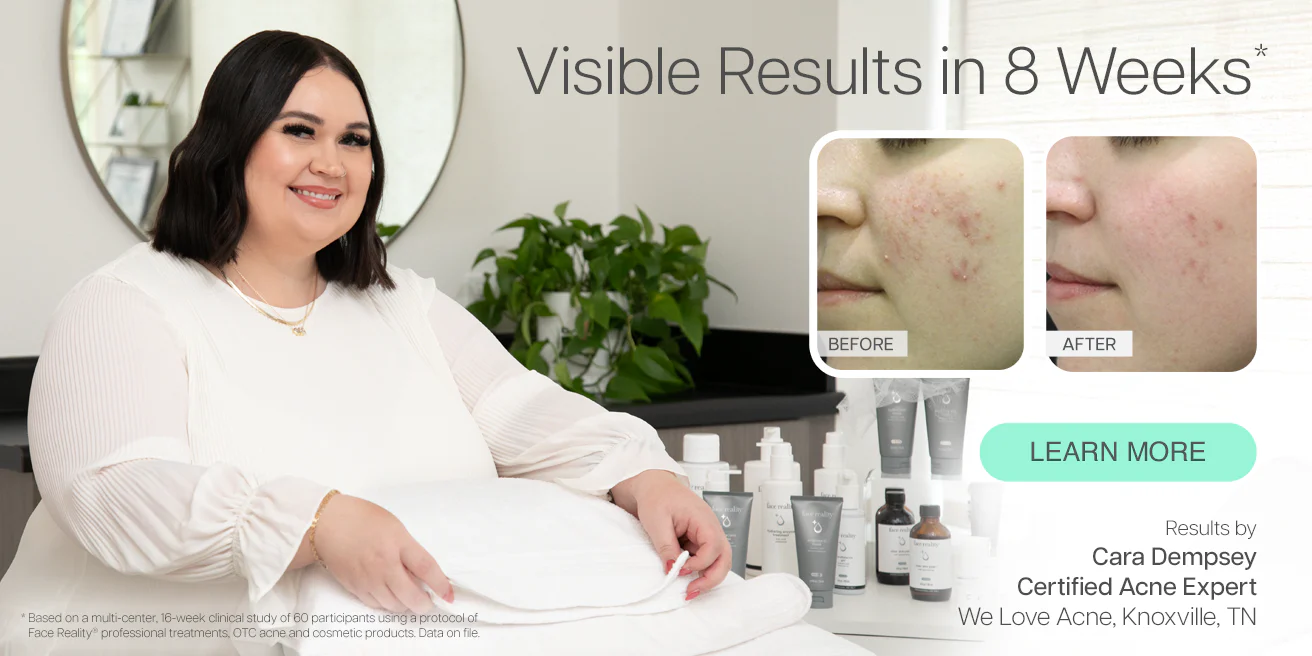 Your Journey to Clear Skin